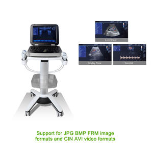 Produsen mesin <span class=keywords><strong>ultrasound</strong></span> untuk mesin pemindai <span class=keywords><strong>ultrasound</strong></span> tubuh kehamilan manusia - Product Image 3