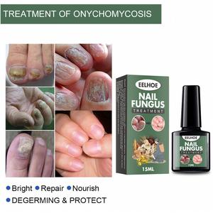 Solution liquide <span class=keywords><strong>de</strong></span> réparation des ongles personnalisée, <span class=keywords><strong>antifongique</strong></span>, <span class=keywords><strong>antifongique</strong></span>, soin des ongles des orteils, soin des mains et des pieds contre l'onychomycose - Product Image 5
