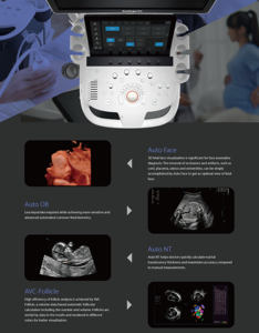 Sonoscape P9Elite Fonction IA Échographie Doppler couleur Diagnostique 21,5 pouces Haute résolution Gynécologie Cardiologie Appareil d'échographie - Product Image 4