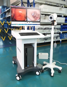Sistem pencitraan colposkop <span class=keywords><strong>Video</strong></span> ginekologi Digital elektronik portabel Colposcope Pemeriksaan Vagina untuk ginekologi - Product Image 4