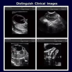 Sistem ultrasonik Doppler warna hewan Laptop bagus untuk pemindai <span class=keywords><strong>Ultrasound</strong></span> paku keling ternak hewan - Product Image 2
