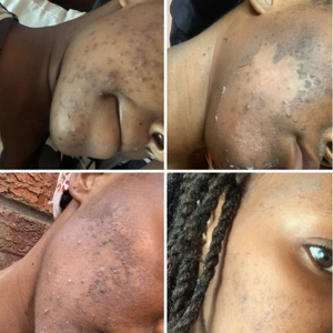 Espículas <span class=keywords><strong>de</strong></span> Esponja Spongilla, <span class=keywords><strong>Algas</strong></span> Exfoliantes 99% Blancas, Esponja Orgánica para Microneedling, Polvo <span class=keywords><strong>de</strong></span> <span class=keywords><strong>Algas</strong></span> Hidrolizadas Puro para Blanqueamiento Facial - Product Image 2