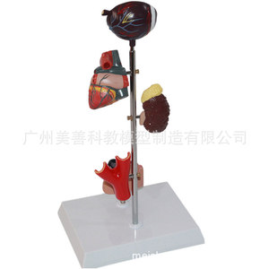 Modelos de patología de la diabetes, modelos de corazón, modelos de riñón, modelos de ojo, modelos de pie diabético, modelos de diabetes - Product Image 2