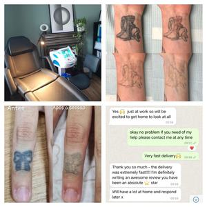 Borrador de tatuaje <span class=keywords><strong>láser</strong></span> diodo de picosegundo 755nm interruptor Q 1320nm cuidado facial 532nm Nd Yag 1064nm pigmentación ceja dispositivo Trmoval - Product Image 6