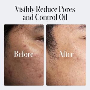 Private Label Deep Cleansing BHA Exfoliating Acne Oil Control Facial <b>Cleanser</b> 2% Salicylic Acid Face Cleans Wash <b>for</b> Men - Product Image 6