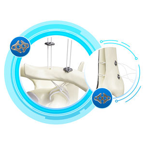 CANWELL Artroscopia Botón Acromio Clavicular Articulación Botón AC Reparación Botón Ortopédico Medicina Deportiva - Product Image 3