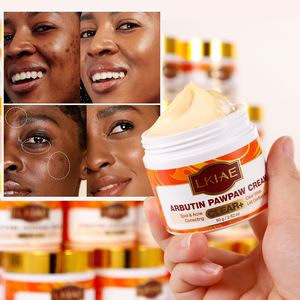 Crema Facial Blanqueadora e Iluminadora Natural con Arbutina y Niacinamida, Reduce <span class=keywords><strong>Manchas</strong></span> Oscuras y Acné, Hidrata y Limpia <span class=keywords><strong>la</strong></span> Piel - Product Image 1