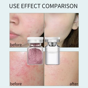 <span class=keywords><strong>เซ</strong></span><span class=keywords><strong>รั่</strong></span><span class=keywords><strong>ม</strong></span>บำรุงผิวสาหร่ายสาหร่ายสาหร่ายช่วยให้ผิวคืนความอ่อนเยาว์ให้ผิวได้อย่างเข้<span class=keywords><strong>ม</strong></span>ข้นจากพืชผลิตภัณฑ์ดูแลผิวสำหรับการแก้ไขจุดด่างดำ - Product Image 4