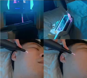 Lápiz de Plasma Frío 6 en 1 con Ozono para el Cuidado de la Piel, Eliminación de Pecas, Lifting Facial, Reafirmación de la Piel, Limpieza, Máquina de Fibroblastos - Product Image 2