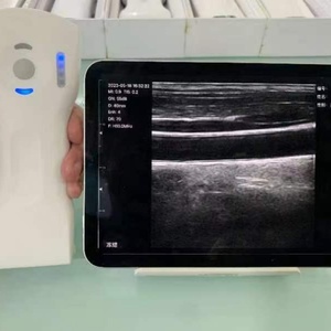 Échographe portable DCU19H 64 canaux, scanner d'échographie médicale sans fil Wi-Fi couleur - Product Image 4