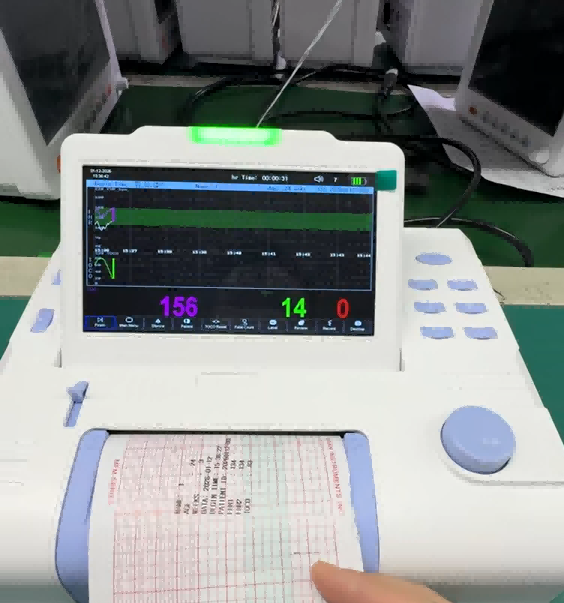 胎児心拍モニター　CTG 胎心监护仪 Alibaba.com上の高品質なポータブルCTG胎児心拍モニターメーカーと