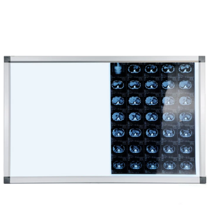 Visualiseur d'images radiographiques pour service de réparation avec 2 panneaux, lampe de projection, lampes de visualisation double et triple - Product Image 1