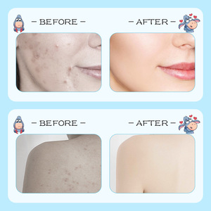 Vente en gros Savon soin du visage élimination ancienne peau soyeuse nettoyage en profondeur Savon artisanal blanchissant au <span class=keywords><strong>lait</strong></span> <span class=keywords><strong>d</strong></span>'ânesse - Product Image 3