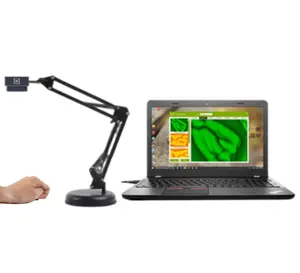 MC410 New generation upgraded portable infrared vein finder viewer with computer software and clear image