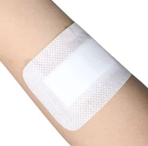 Kit de Apósito Médico Autoadhesivo de Alginato de Calcio para Heridas - Product Image 2