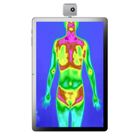 Caméra thermique infrarouge pour la détection de la santé des athlètes et la surveillance sportive