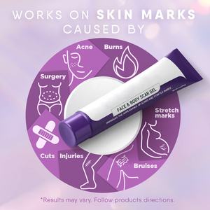 เจลลดรอย<span class=keywords><strong>แผล</strong></span><span class=keywords><strong>เป็น</strong></span>บนใบหน้าและร่างกาย ครีมซ่อมแซมรอย<span class=keywords><strong>แผล</strong></span><span class=keywords><strong>เป็น</strong></span>จากการผ่าตัด รอยแผล<span class=keywords><strong>เป็น</strong></span>เก่าและใหม่ รอยแตกลาย <span class=keywords><strong>แผล</strong></span>จากการผ่าตัด <span class=keywords><strong>แผล</strong></span>จากการบาดเจ็บ <span class=keywords><strong>แผล</strong></span>ไฟไหม้ สิว - Product Image 2