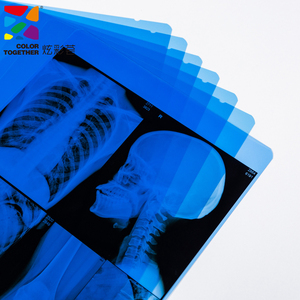 Y tế x Ray phim màu xanh với phù hợp cơ sở - Product Image 4