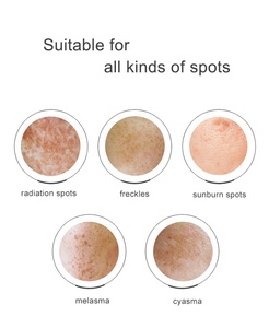 Venta al por mayor de la buena calidad de Arbutina regaliz blanqueamiento de la piel peca mancha el <span class=keywords><strong>melasma</strong></span> libre oscuro crema de punto - Product Image 6