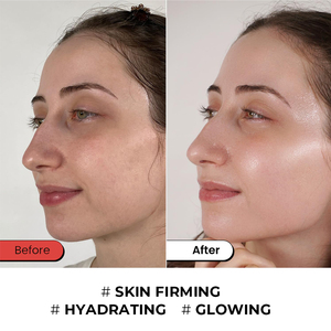 Набор для ухода за кожей лица Private Label: Веганский комплекс с эпидермальным фактором роста для восстановления, омоложения, против морщин и для отбеливания кожи - Product Image 5