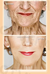 Crème <span class=keywords><strong>anti</strong></span>-âge à base de peptides OTVENA, marque célèbre, pour éliminer rapidement les rides - Product Image 2