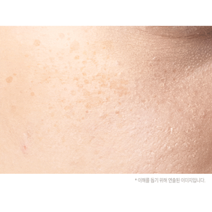 Crema Facial Blanqueadora Anti-Melanina con Niacinamida para Pecas 30g Coreana - Product Image 4