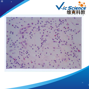 Patologie-Objektträger Lehrmittel <span class=keywords><strong>Tumor</strong></span>-Experimentierausrüstung und Artikel Professionelle Hersteller Patologie-Objektträger - Product Image 5