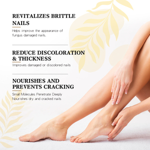 West Month Repair Oil Pen Main et Pied Gris Clean Soft Rotten Nails Solution de soin des <span class=keywords><strong>ongles</strong></span> <span class=keywords><strong>d</strong></span>'orteils épaississants - Product Image 3