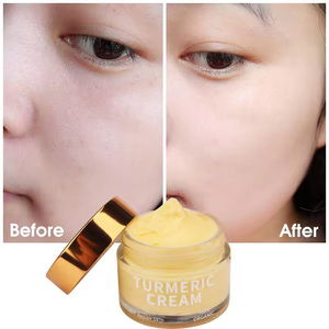 Crema Viso OEM Private Label Naturale con Vitamina C, Niacinamide e Curcuma <span class=keywords><strong>per</strong></span> Pelli a Tendenza Acneica, Idratante e Illuminante - Product Image 2