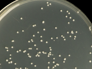 Agar de Patata y Dextrosa (Marca Haibo, Origen Shanghái, China, CAS 0233-12) para la enumeración de moldes y levaduras (Farmacópoea China) - Product Image 3