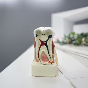 Modelo <span class=keywords><strong>de</strong></span> Patología Dental para Educación Dental y Laboratorio Dental, Modelo <span class=keywords><strong>de</strong></span> Estudio Dental - Product Image 3
