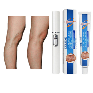 EELHOE Crema para Várices, Crema para el Tratamiento de Várices Reticulares y Úlceras Troféricas, Set de Lápiz Láser para Arañas Vasculares - Product Image 1