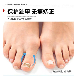 Pegatinas correctoras de uñas, pegatinas para uñas encarnadas sin pegamento, correctores de ranuras de uñas, tiradores, recortadores de uñas encarnadas - Product Image 4