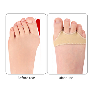 Tissu <span class=keywords><strong>Métatarsien</strong></span> Boule de Pied Coussin Manches Sensations de Brûlure Avant-Pied Ampoules Métatarsalgie Soulagement De La Douleur - Product Image 6