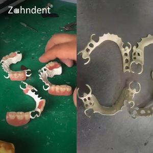 Zahndent 98/95/92 كتل <span class=keywords><strong>Pmma</strong></span> Cam لطحن الأسنان ، قرص <span class=keywords><strong>Pmma</strong></span> متعدد الطبقات - Product Image 2