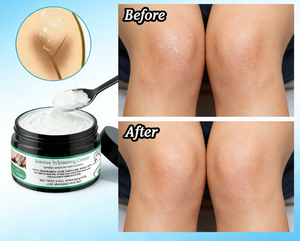 Crème éclaircissante et blanchissante intense pour l'élimination des taches brunes <span class=keywords><strong>sur</strong></span> le corps, <span class=keywords><strong>les</strong></span> aisselles, le maillot et l'intérieur des <span class=keywords><strong>cuisses</strong></span>, marque privée OEM - Product Image 1