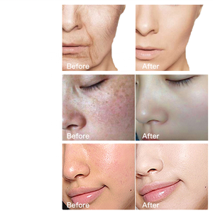 Grosir Set Perawatan Kulit kolagen pelembap pemutih wajah, manfaat <span class=keywords><strong>Anti</strong></span> Keriput dan penuaan organik alami - Product Image 3