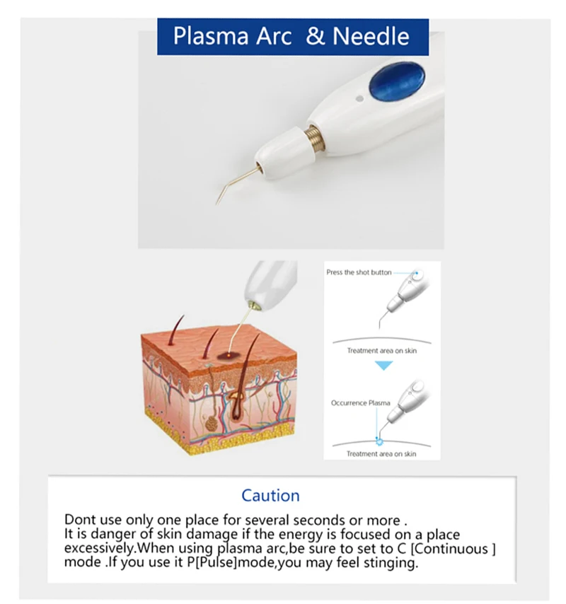 Plumas de la belleza del plamere del fibroblasto de la elevación del tratamiento de la piel de la pluma del plasma del uso médico del coreano