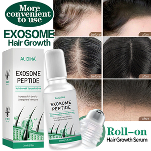 Siero Professionale per la Crescita dei Capelli per Cliniche di Trattamento del Cuoio Capelluto, Rigenerazione e Rafforzamento dei Capelli, Trattamento Riparatore del Cuoio Capelluto, Anti-Caduta - Product Image 1