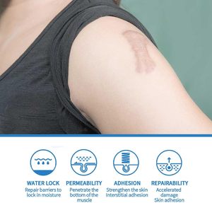 Gel réparateur de cicatrices en <span class=keywords><strong>silicone</strong></span> ETRUN ALISA, marque privée, efficace contre l'acné, les boutons, les vergetures, les marques de cicatrices, crème anti-cicatrices - Product Image 5