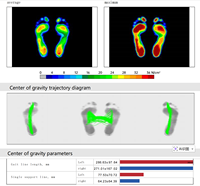 Perangkat Pemindaian Kaki 3D Cerdas dan Pemetaan Tekanan untuk Pembuatan Orthotics yang Dipersonalisasi