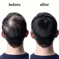 Serum Rambut Peptida Tembaga Organik Kustom OEM/ODM Tripeptida-1 Kompleks Peptida Ganda Aroma Akar Licorice dan Jeruk