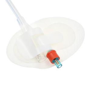 Üretral Kateter Tek Kullanımlık Çanta Sabitleyici Kateter Sabitleme Cihazı Tıbbi Kateter Sabitleme Tıpası - Product Image 4