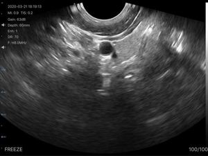 <span class=keywords><strong>Sonde</strong></span> linéaire rectale portative sans fil à ultrasons B, avec matrice convexe/ligne linéaire, pour la mesure de la gestation vétérinaire transrectale - Product Image 6