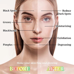 Mặt nạ giấy dưỡng ẩm làm sáng da tốt nhất, sản xuất theo đơn đặt hàng (OEM/ODM), nhãn hiệu riêng, kiểm soát dầu, vitamin C, chiết xuất trái cây - Product Image 6