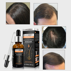 Nhãn hiệu riêng chăm sóc tóc tăng trưởng dầu Biotin mọc lại điều trị cho da đầu rụng tóc mỏng tóc tăng trưởng tinh dầu - Product Image 3