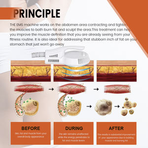 화메이 신형 <span class=keywords><strong>EMS</strong></span> RF 근육 자극기 휴대용 디자인 효과적인 바디 쉐이핑을 위한 저렴한 선택 <span class=keywords><strong>EMS</strong></span> 트레이닝 - Product Image 6