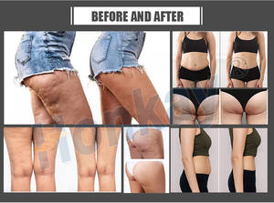 Appareil <span class=keywords><strong>de</strong></span> massage corporel professionnel 2026 à 24 chambres d'air pour la réduction <span class=keywords><strong>de</strong></span> la cellulite, le remodelage corporel et la récupération - Product Image 4