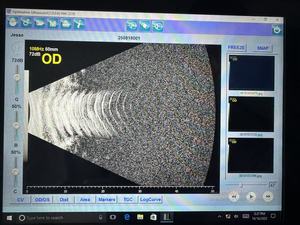 Dispositivo <span class=keywords><strong>de</strong></span> Ultrasonido Oftálmico Médico AB Scan para Examen <span class=keywords><strong>de</strong></span> <span class=keywords><strong>Cataratas</strong></span> <span class=keywords><strong>y</strong></span> <span class=keywords><strong>Retina</strong></span> ABS-500 - Product Image 2