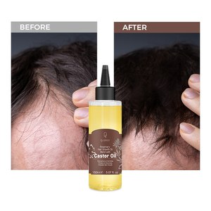 Qquaker <span class=keywords><strong>Aceite</strong></span> <span class=keywords><strong>De</strong></span> Romero Para El Crecimiento Del Cabello <span class=keywords><strong>Aceite</strong></span> <span class=keywords><strong>De</strong></span> <span class=keywords><strong>Ricino</strong></span> <span class=keywords><strong>Aceite</strong></span> <span class=keywords><strong>De</strong></span> Crecimiento Del Cabello Para Hombres <span class=keywords><strong>Aceite</strong></span> <span class=keywords><strong>De</strong></span> Cabello Orgánico - Product Image 2